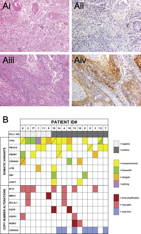 Frequent Pd L Protein Expression And Molecular Correlates In Urinary