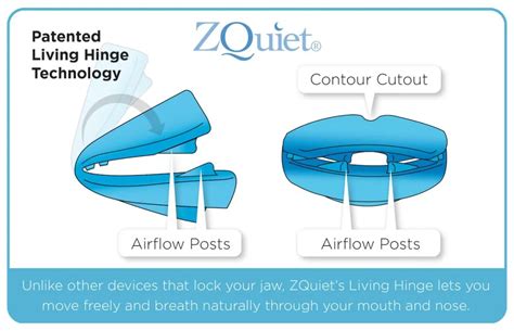 Sleep Apnea Mouth Guards Everything You Need To Know