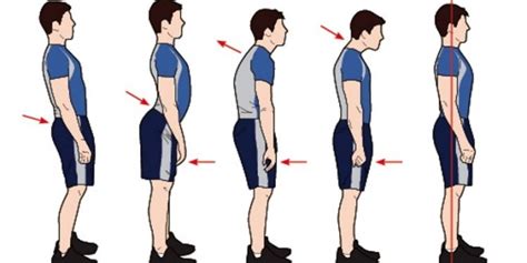 Stop Slouching Heres How To Improve Your Posture Health Normal