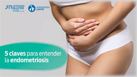 5 Claves Para Entender La Endometriosis Youtube