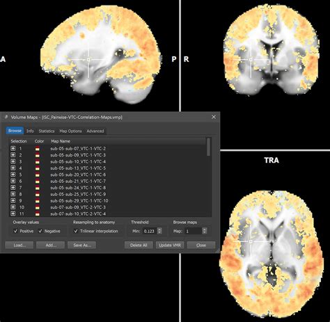 Whole Brain Isc Analysis