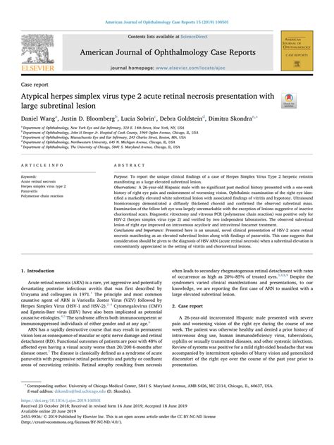 Pdf Atypical Herpes Simplex Virus Type 2 Acute Retinal Necrosis