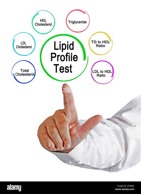 Lipid Profile Hi Res Stock Photography And Images Alamy