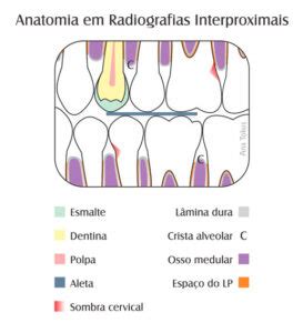 Anatomia Em Radiografias Interproximais Abro