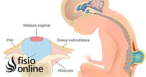 Tubo neural | Qué es, cómo se forma y defectos neuronales