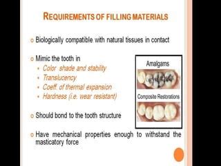 introduction to tooth filling materials dental material | PPT