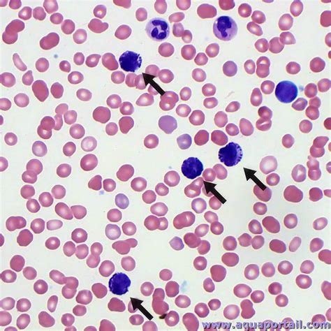 Basophile définition et explications