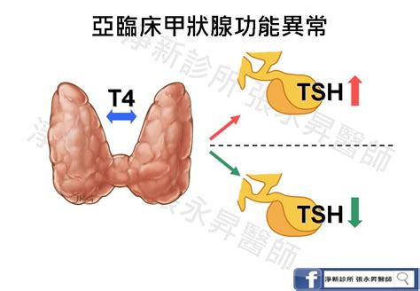 亞臨床甲狀腺功能異常