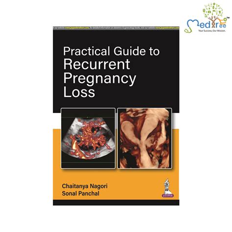 Buy Practical Guide To Recurrent Pregnancy Loss Medtree Co In