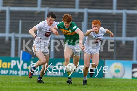 S Kerry V Kildare Kerry S Eye Photo Sales