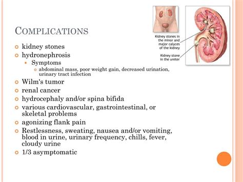 PPT - Horseshoe Kidney PowerPoint Presentation, free download - ID:3008130