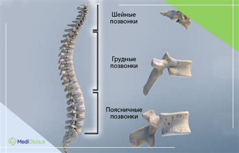 Кровать при компрессионном переломе позвоночника 96 фото