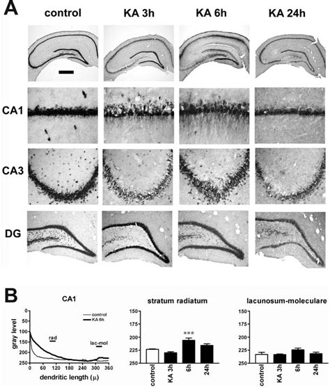 Kainate Seizures Induce Dendritic Targeting Of Bdnf Mrna In Ca