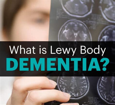 Lewy Body Dementia Vs Parkinson Symptoms