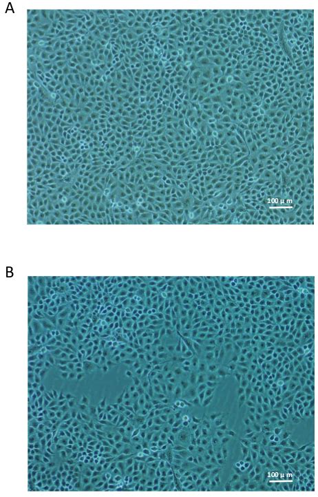 Measuring Influenza Neutralizing Antibody Responses To A H N Viruses