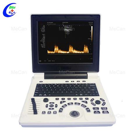 Color Doppler Ultrasound - Fetal Imaging