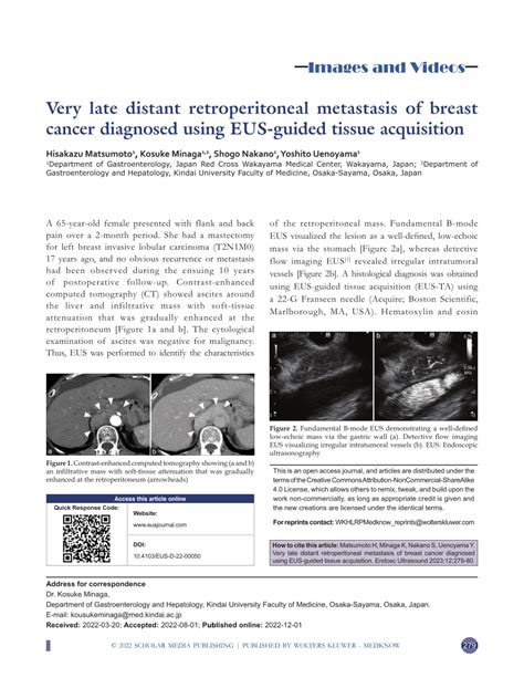 Pdf Very Late Distant Retroperitoneal Metastasis Of Breast Cancer