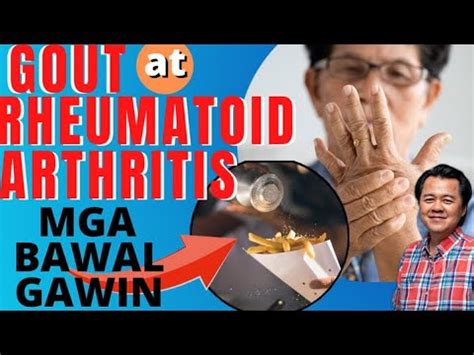 Mga Bawal Gawin Gout At Rheumatoid Arthritis Payo Ni Doc Willie Ong