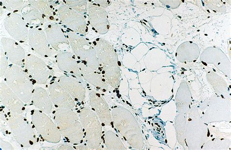 Emerin - IHC Primary Antibodies