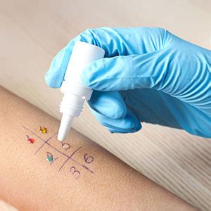 МЦ НОЛЕКС | Медицински център Нолекс