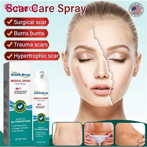 South Moon Scar Remover Spray Firming Body Treatment Repaire Burn