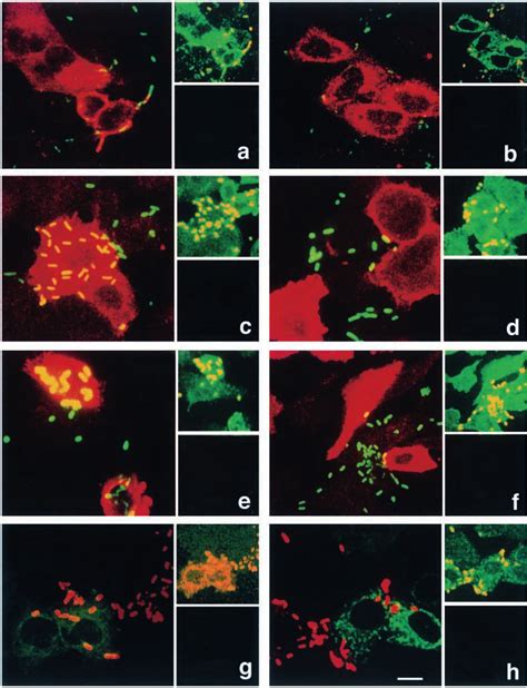 Shigella Uptake By Hela Cells Expressing Dominant Positive And Negative