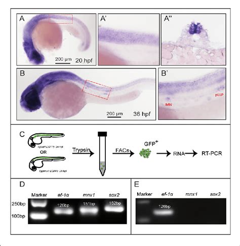 Sex Determining Region Y Box 2 Sox2 Expression Analyses In The Download Scientific Diagram