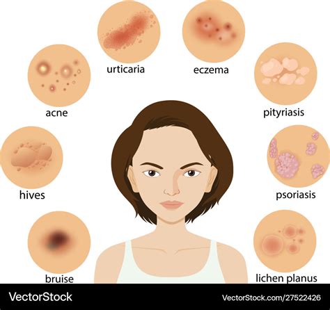 Diagram Showing Different Skin Conditions Vector Image