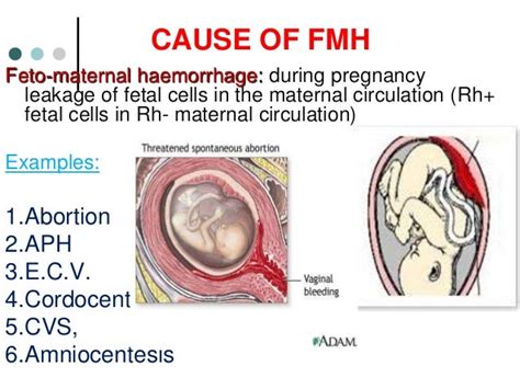 Rh Isoimmunization