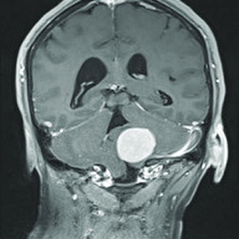 T Axial Weighted Magnetic Resonance Imaging With Contrast