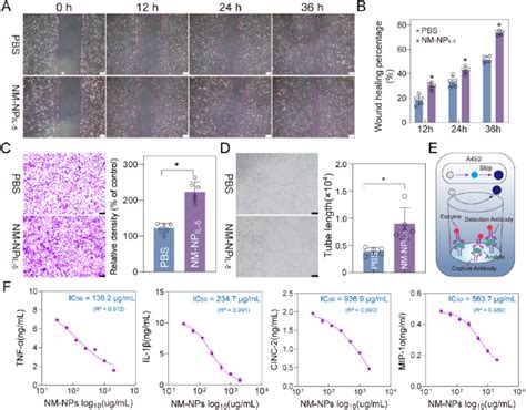 The Pro Angiogenesis And Anti Inflammation Effects Of Nm Np Il 5 In