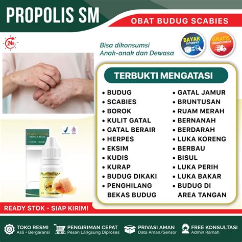 Jual Obat Budug Buduk Obat Herbal Scabies Manusia Penghilang Bekas