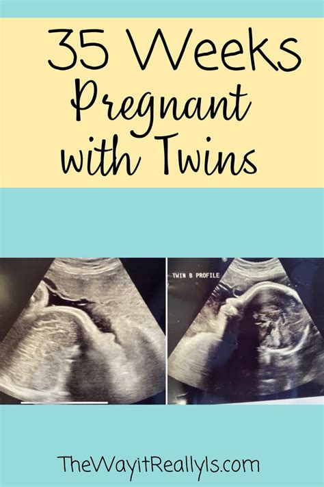 35 Weeks Pregnant With Twins