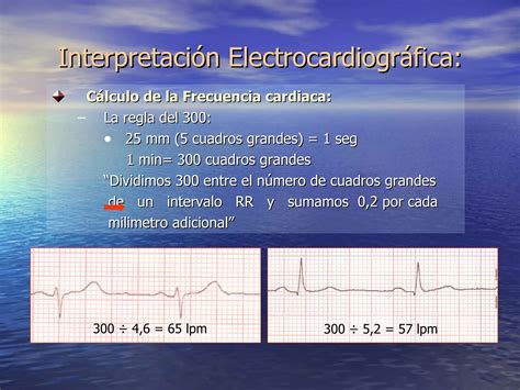 Fisiologia Electrocardiografia Normal Ecg Ppt