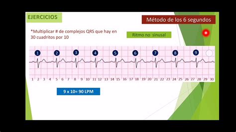 C Mo Calcular La Frecuencia Cardiaca Y Eje Del Coraz N Youtube