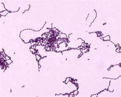 Gram Stain By Sheppard Flashcards Quizlet