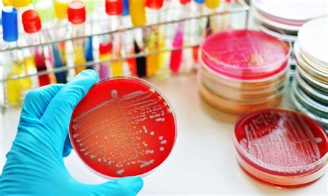 microbiological analysis  water  wastewater laboratory  india