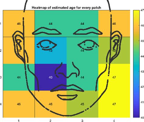 Figure 1 From Do Alzheimers Patients Appear Younger Than Their Ageƒ A