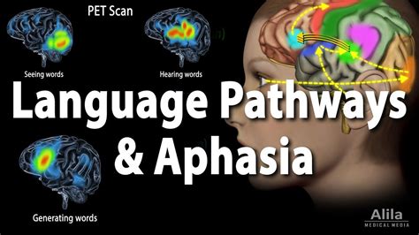 language pathways  aphasia animation youtube