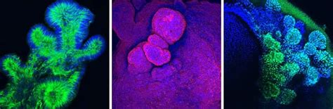 Protocol Guide Immunofluorescent Staining Of Whole Mount Organoids