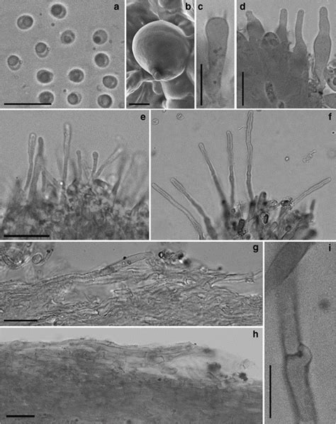 Anupama Indica Facesoffungi Number Fof Faces Of Fungi