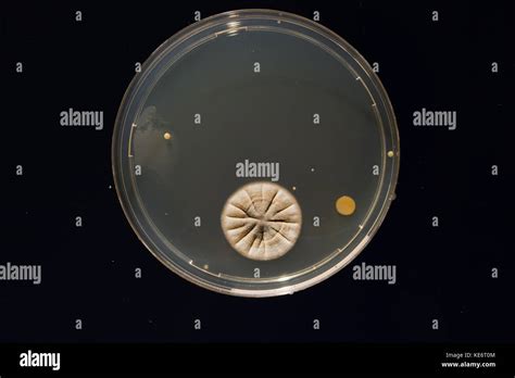 A Petri Dish With Growing Cultures Of Microorganisms Fungi And