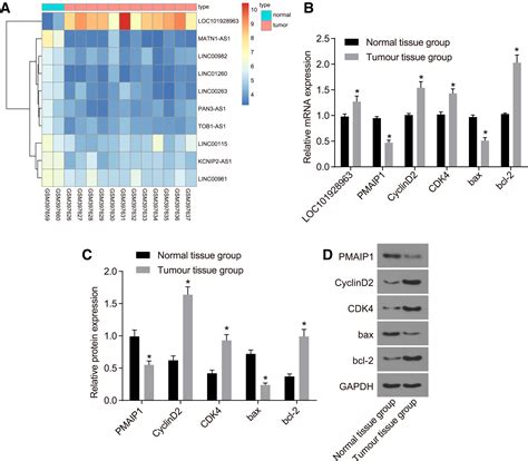 Silencing Lncrna Loc Inhibits Proliferation And Promotes