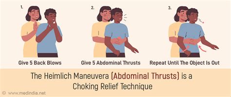 Heimlich Maneuver For Choking In Adults And Infants, 53% OFF