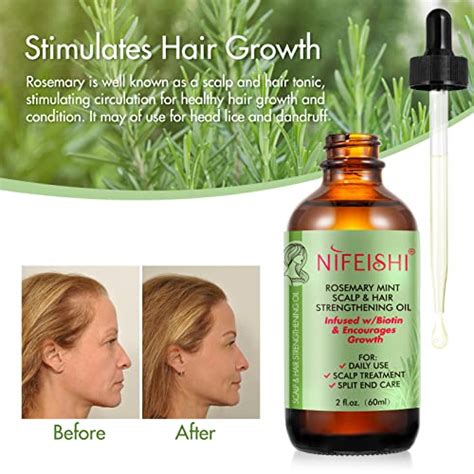 Rosemary Oil For Hair Growth 2 02 Oz Rosemary Mint Scalp Hair