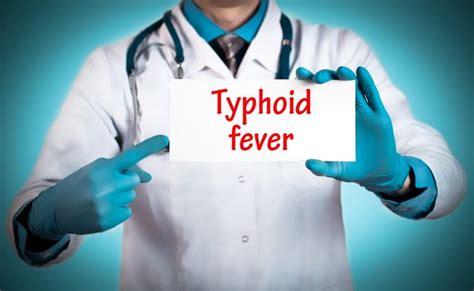 Typhoid Fever Symptoms Clinical Features And Complications