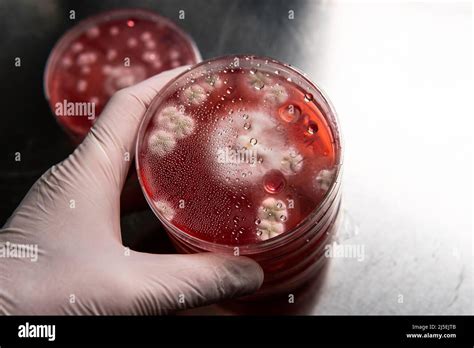 Mold And Bacteria On Red Agar Agar Medium For Pathogens Mold Spores