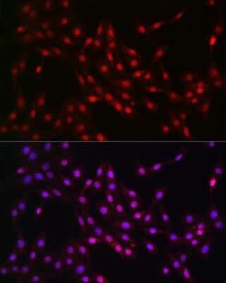 Lactyl Lysine Antibody NBP3 15602 Novus Biologicals