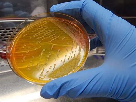 Análise microbiológica de ovo GMO