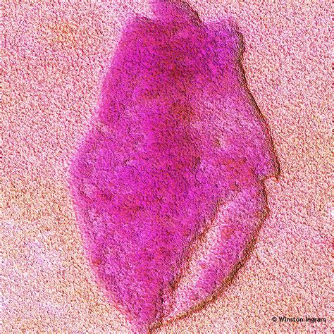 Epithelial | Microbus Microscope Educational Website